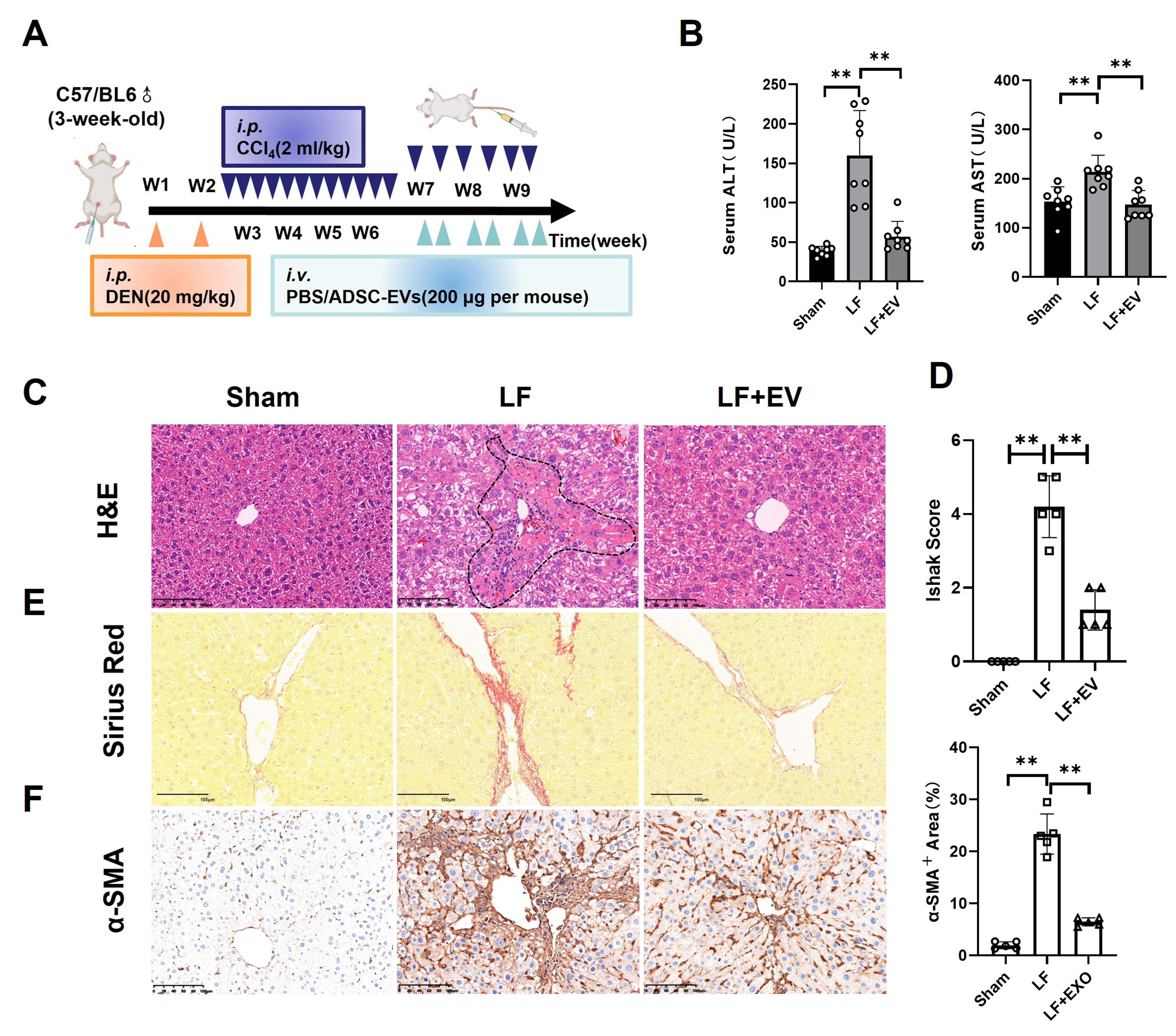 Adipose-derived stem cell extracellular vesicles attenuate liver fibrosis via restoration of gut barrier function and modulation of gut microbiota