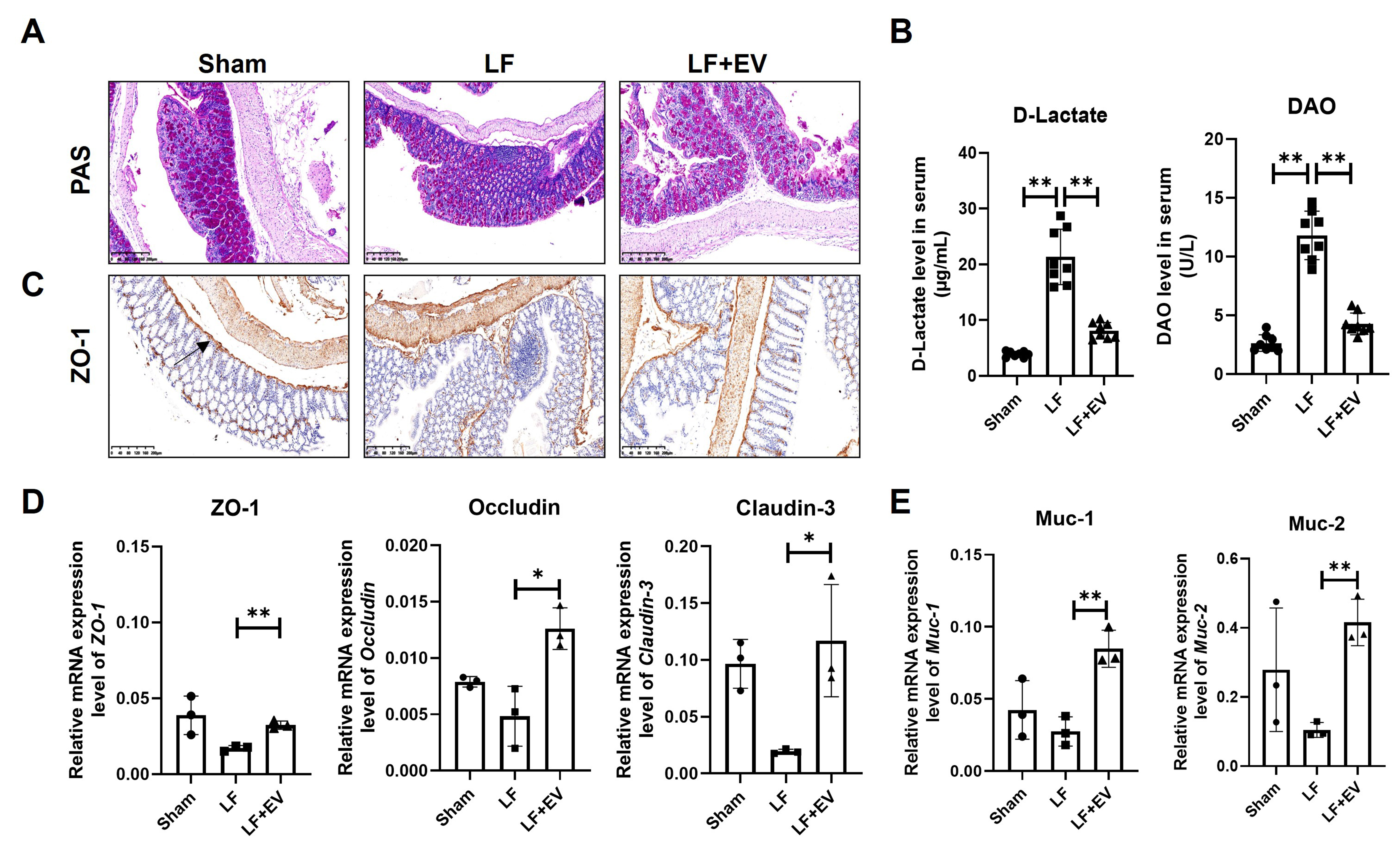Adipose-derived stem cell extracellular vesicles attenuate liver fibrosis via restoration of gut barrier function and modulation of gut microbiota