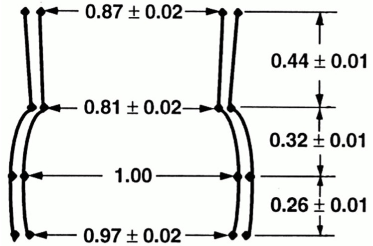 How geometry drives innovation in aortic valve repair