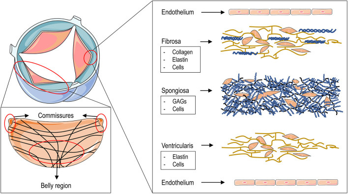 How geometry drives innovation in aortic valve repair