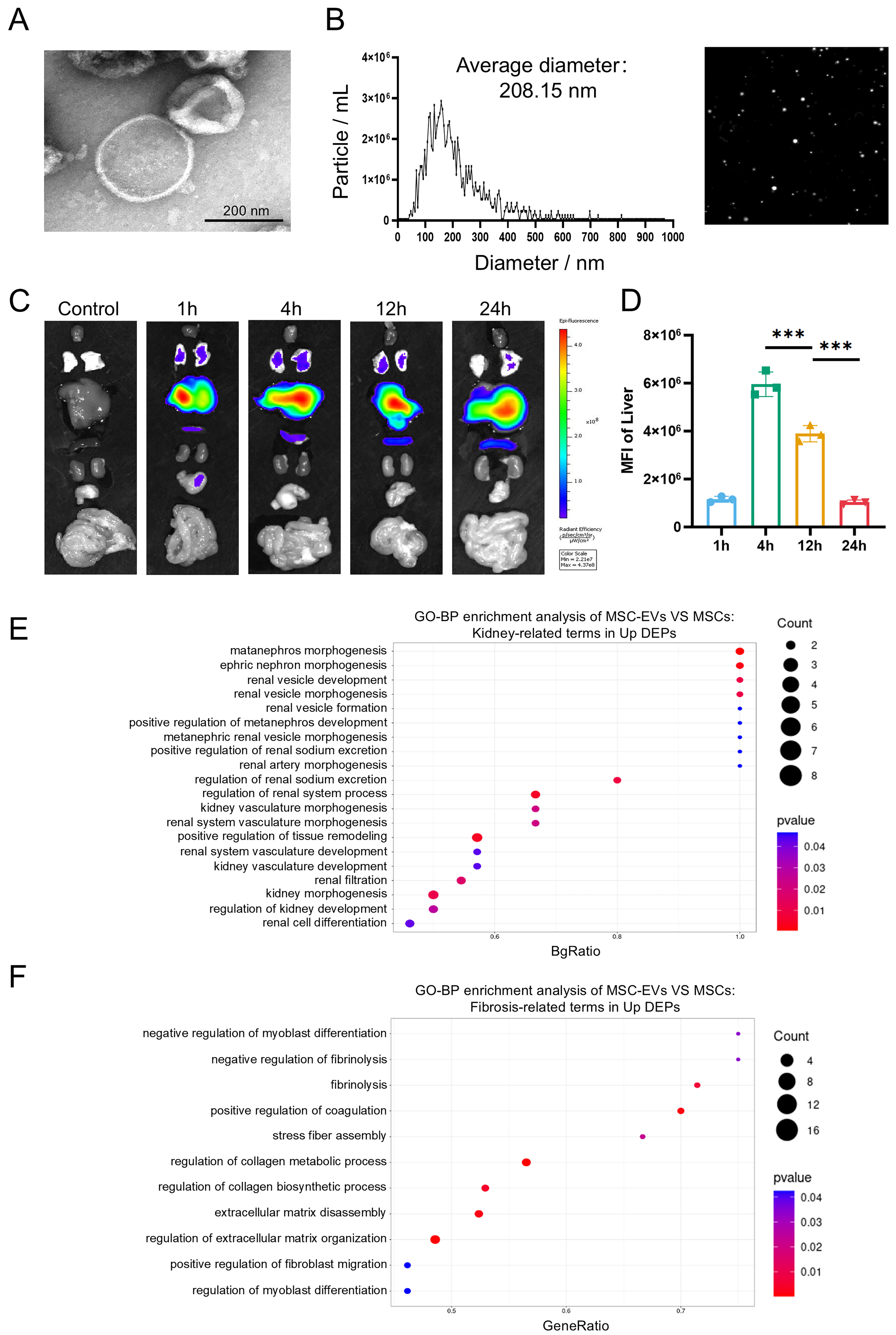 Multiorgan repair by MSC-derived extracellular vesicles in hepatorenal syndrome through necroptosis alleviation, immune reprogramming and fibrosis resolution