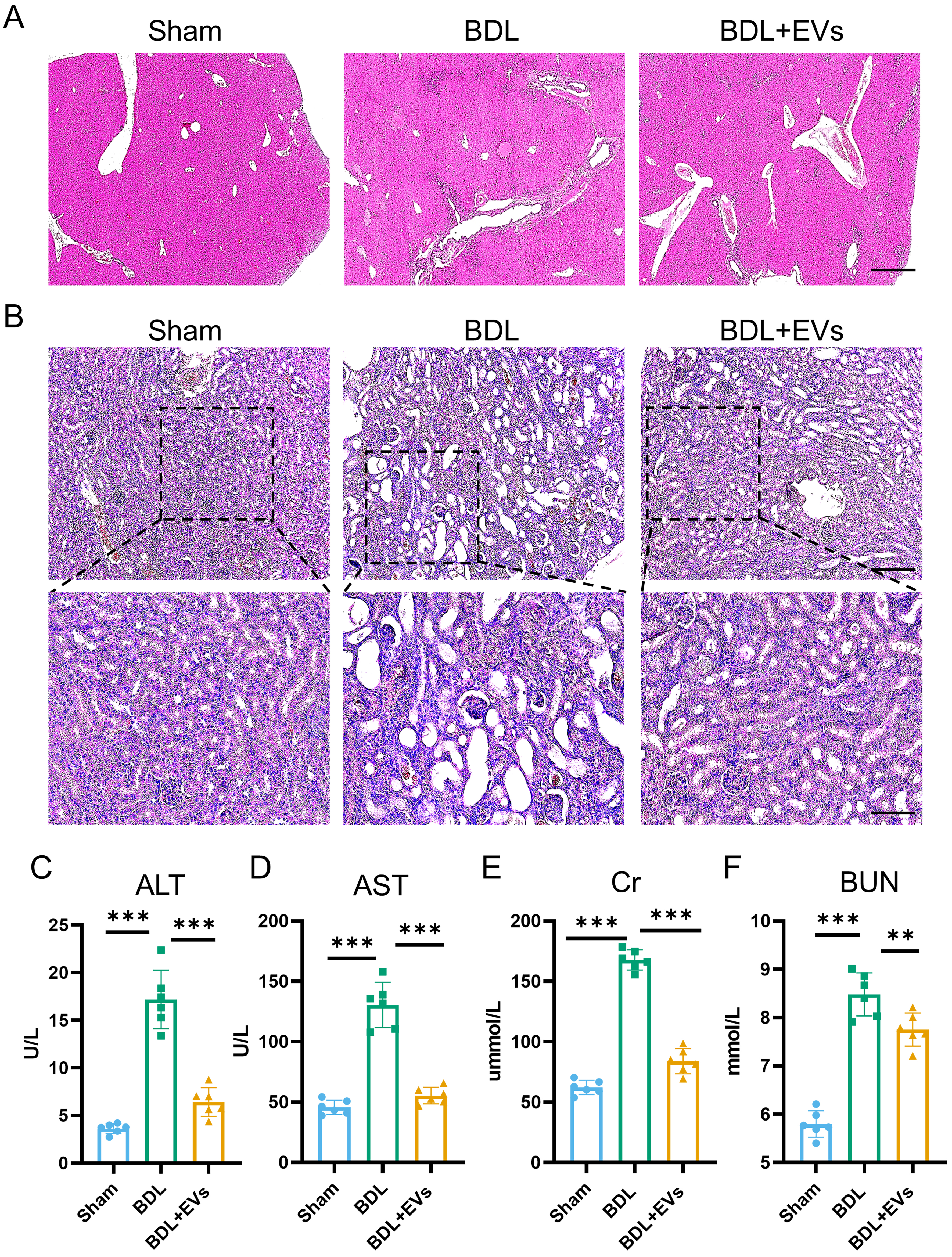 Multiorgan repair by MSC-derived extracellular vesicles in hepatorenal syndrome through necroptosis alleviation, immune reprogramming and fibrosis resolution