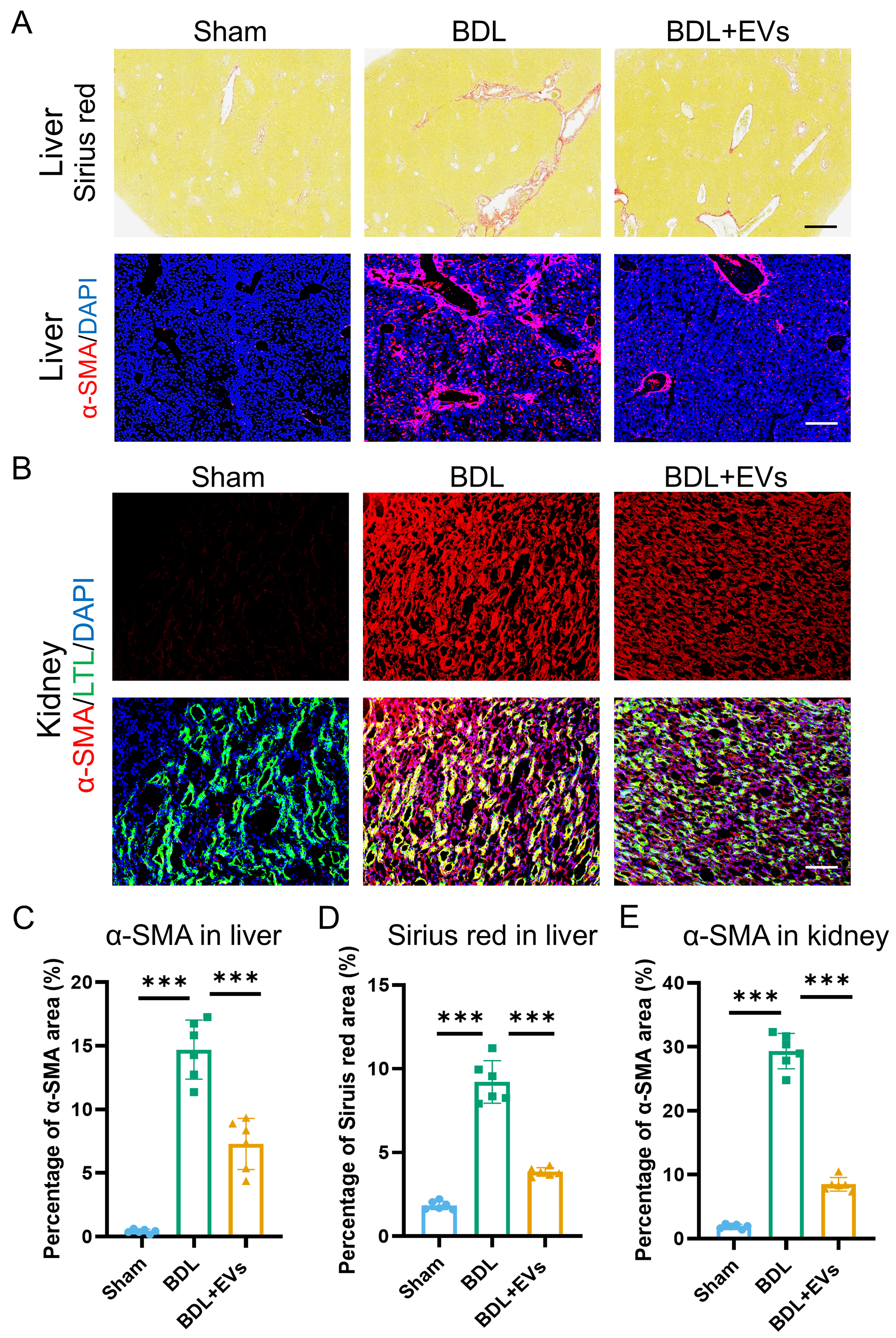 Multiorgan repair by MSC-derived extracellular vesicles in hepatorenal syndrome through necroptosis alleviation, immune reprogramming and fibrosis resolution