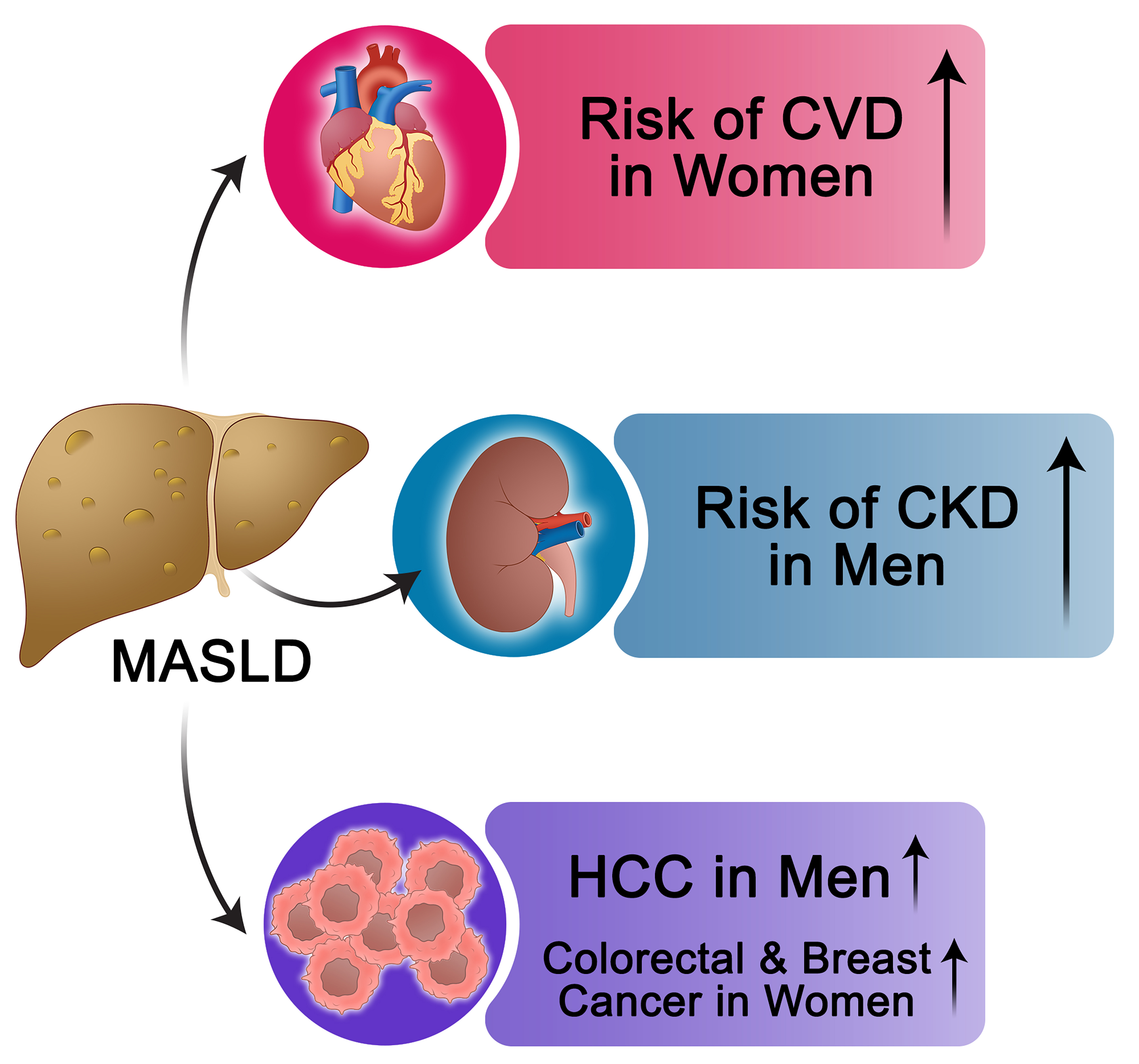 Sex and gender differences in MASLD: pathophysiological mechanisms, clinical implications, and future directions