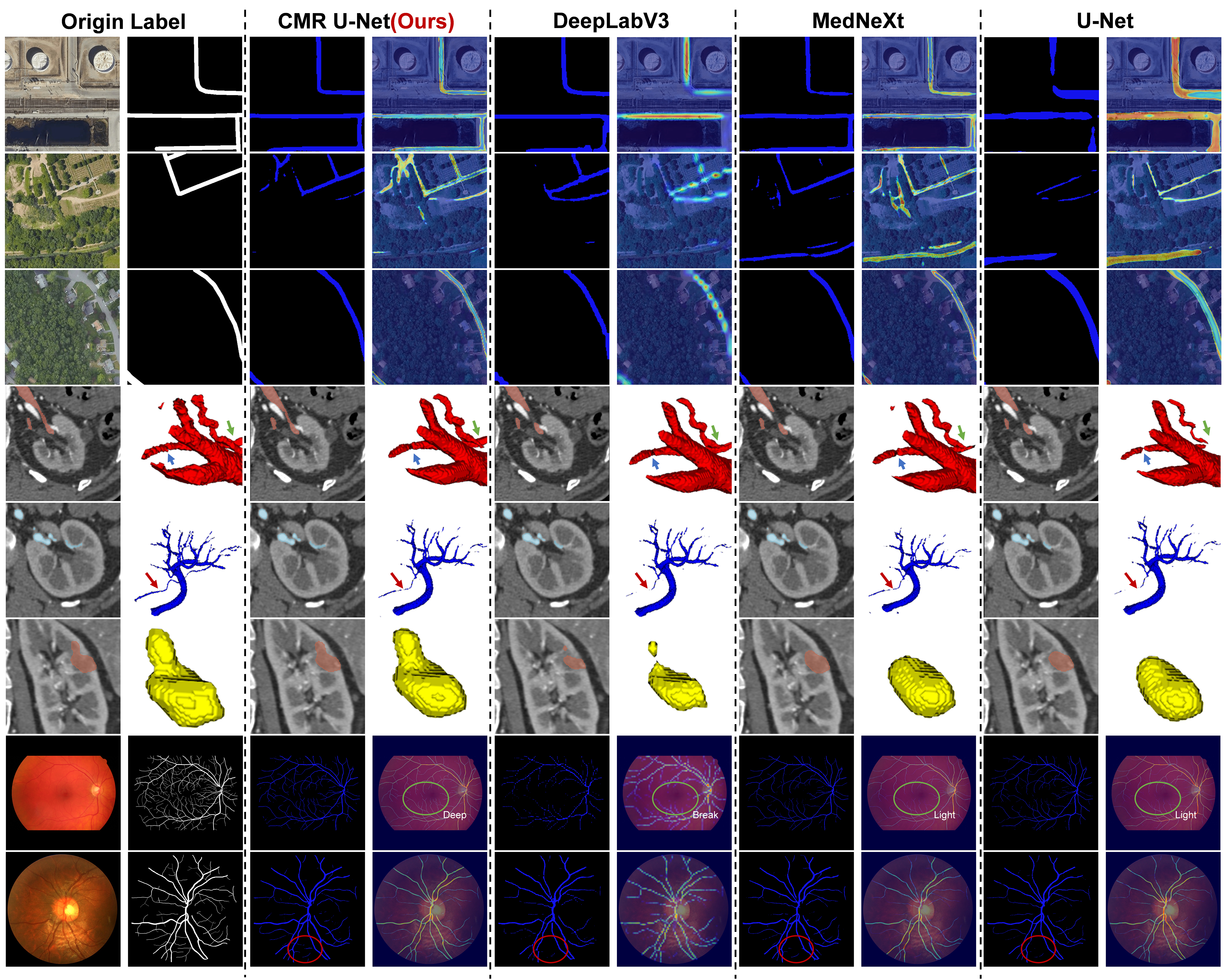 Multi-directional attention: a lightweight attention module for slender structures