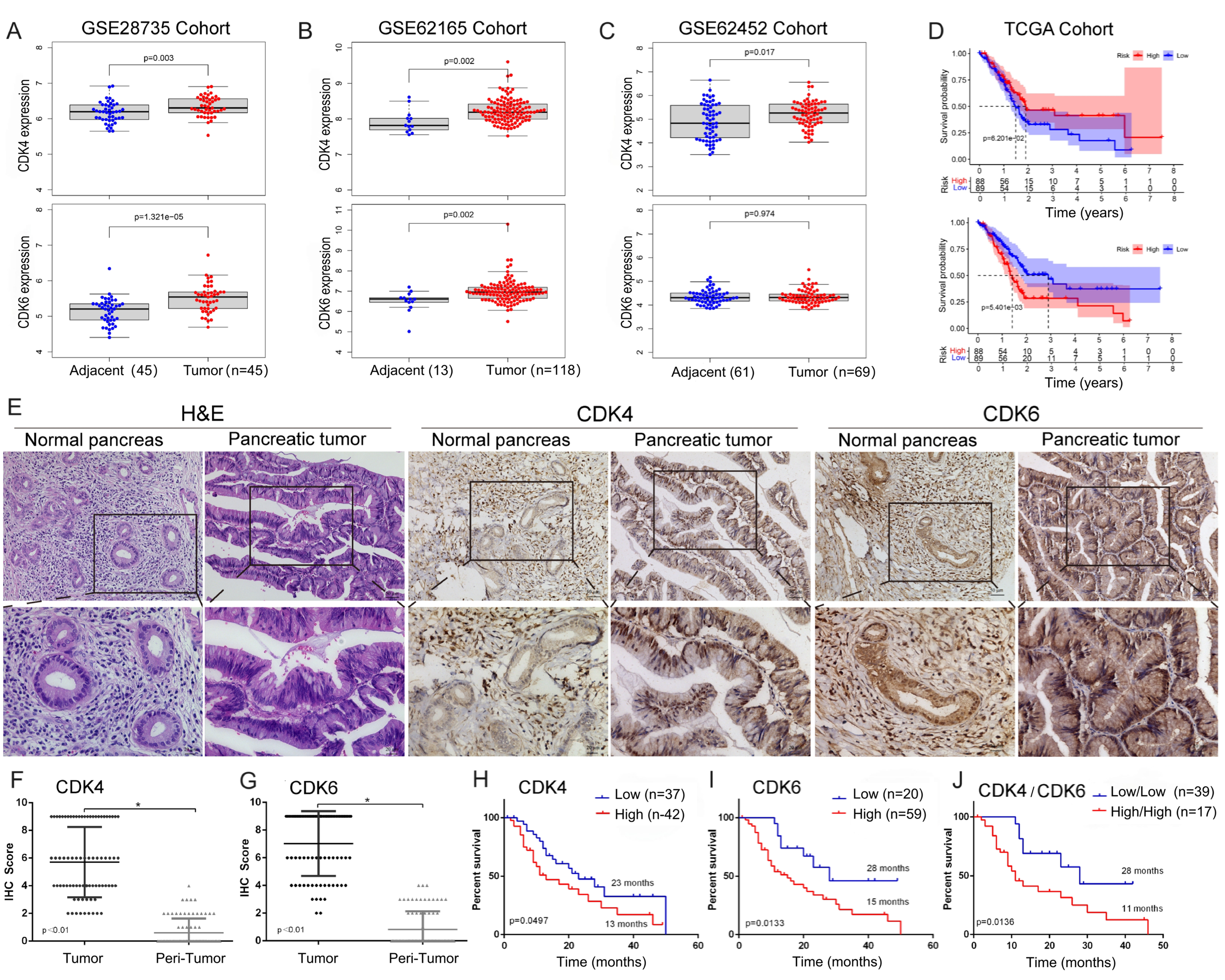 CDK4/6 and BET inhibitors synergistically suppress pancreatic tumor growth and epithelial-to-mesenchymal transition by regulating the GSK3β-mediated Wnt/β-catenin pathway