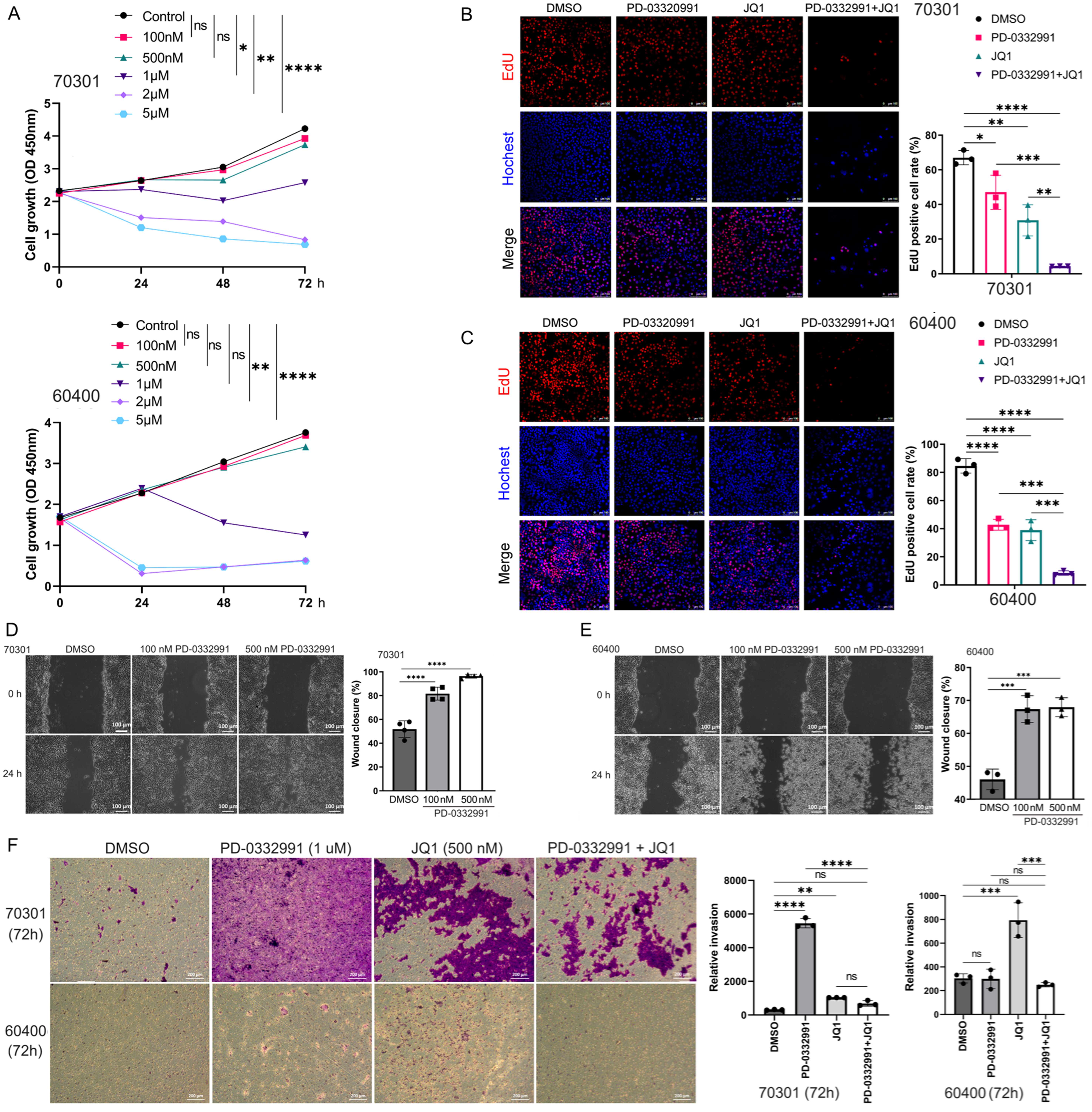 CDK4/6 and BET inhibitors synergistically suppress pancreatic tumor growth and epithelial-to-mesenchymal transition by regulating the GSK3β-mediated Wnt/β-catenin pathway