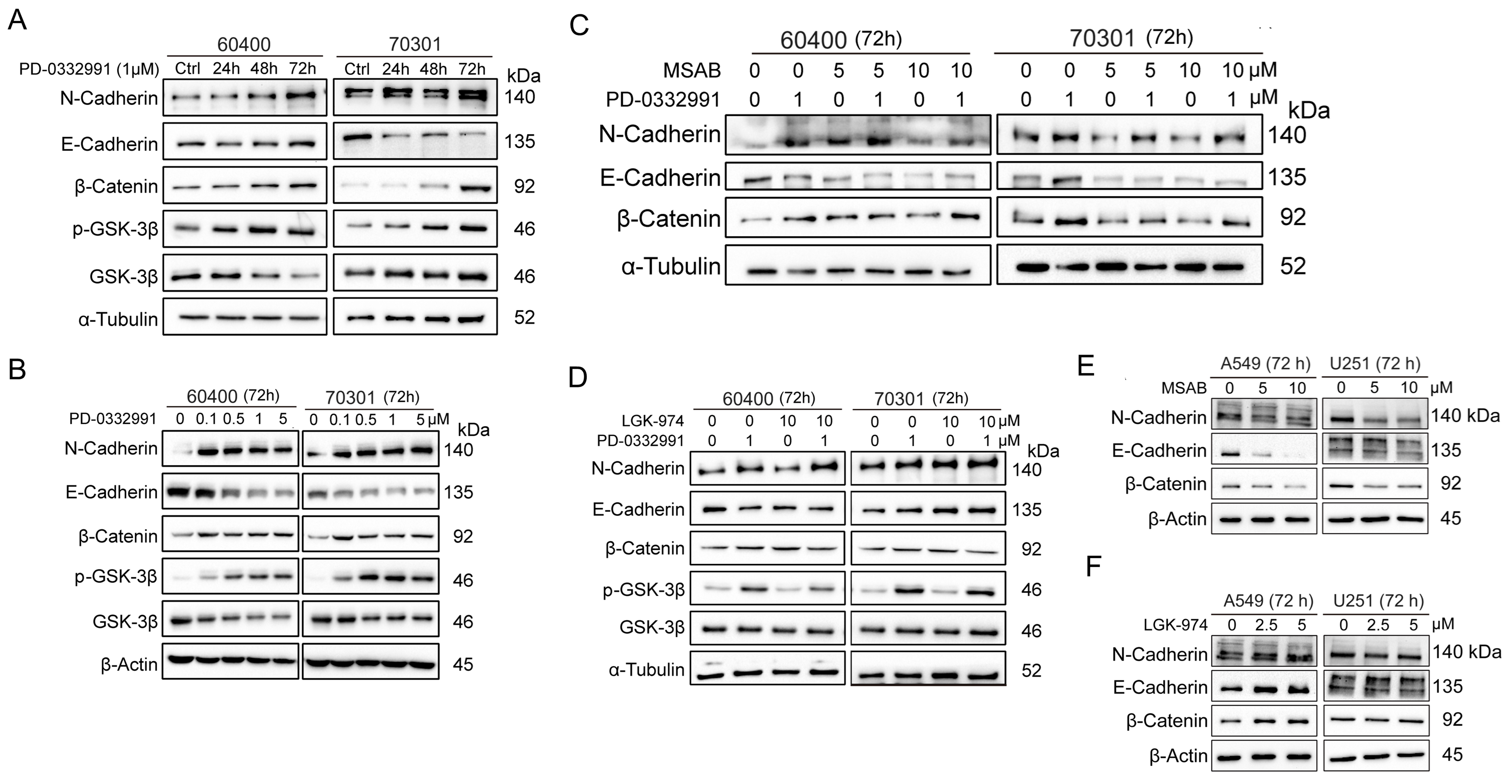 CDK4/6 and BET inhibitors synergistically suppress pancreatic tumor growth and epithelial-to-mesenchymal transition by regulating the GSK3β-mediated Wnt/β-catenin pathway