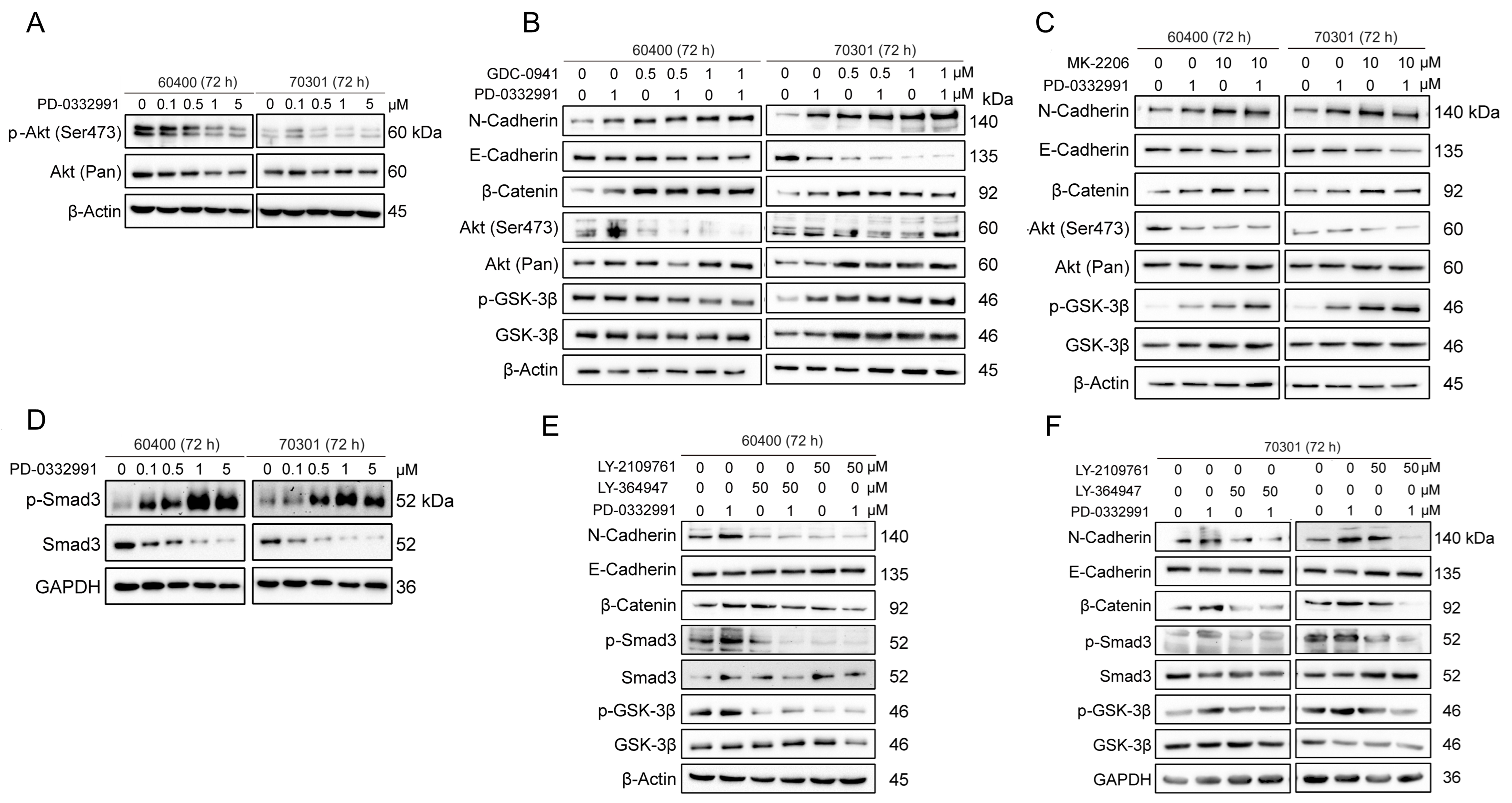 CDK4/6 and BET inhibitors synergistically suppress pancreatic tumor growth and epithelial-to-mesenchymal transition by regulating the GSK3β-mediated Wnt/β-catenin pathway