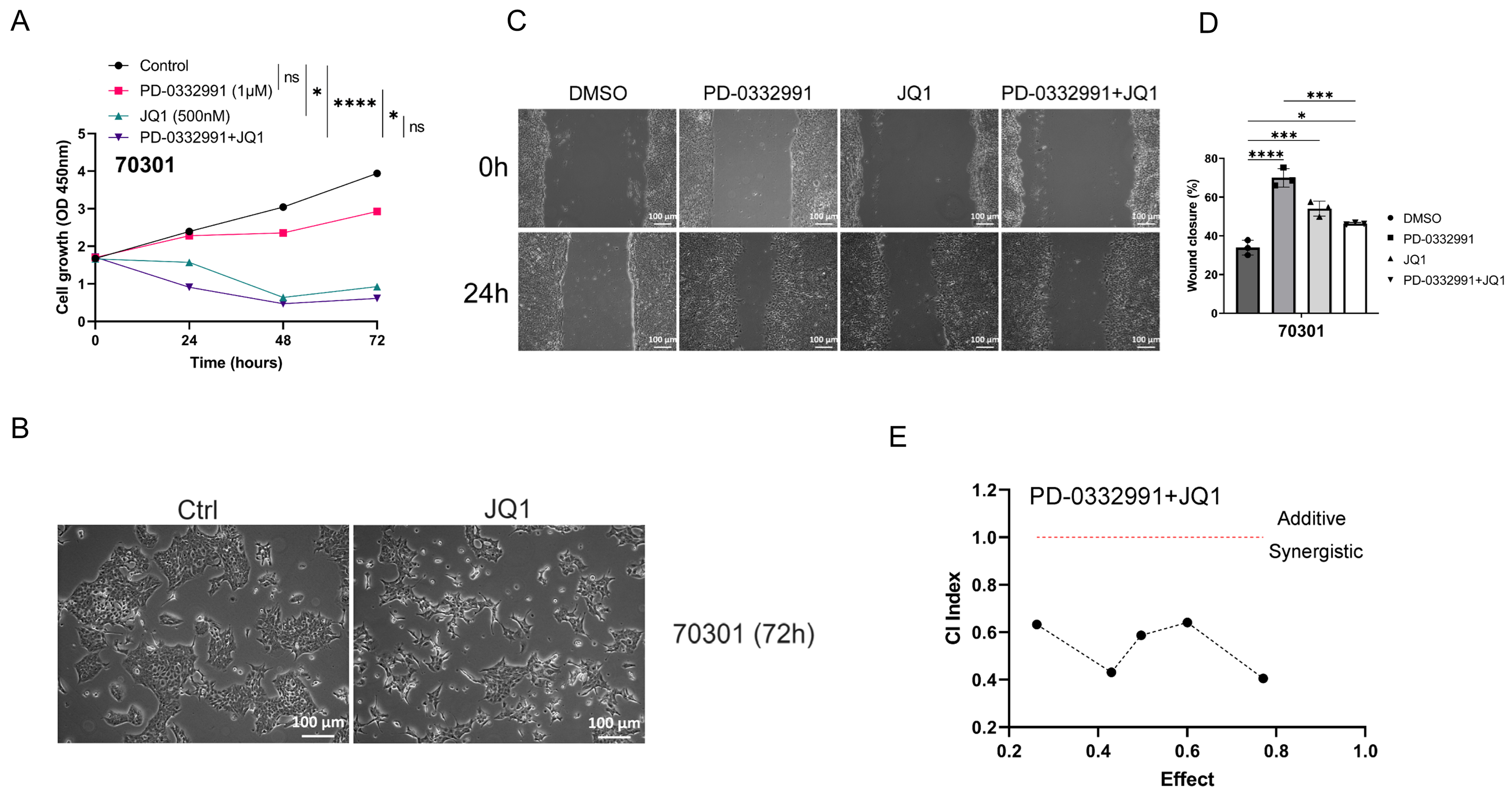 CDK4/6 and BET inhibitors synergistically suppress pancreatic tumor growth and epithelial-to-mesenchymal transition by regulating the GSK3β-mediated Wnt/β-catenin pathway