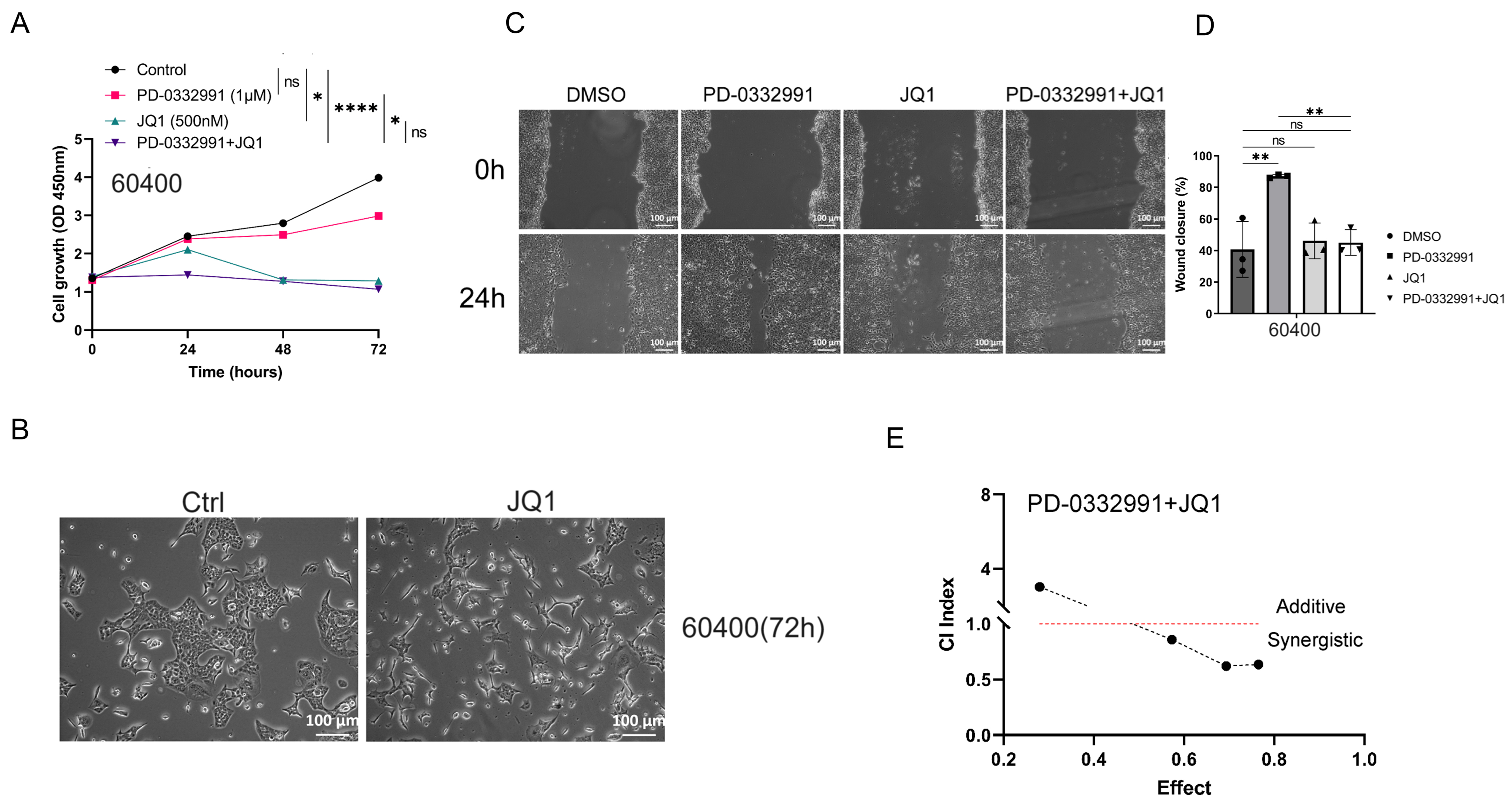CDK4/6 and BET inhibitors synergistically suppress pancreatic tumor growth and epithelial-to-mesenchymal transition by regulating the GSK3β-mediated Wnt/β-catenin pathway